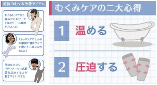 太ももの脂肪吸引のアフターケア（むくみ）